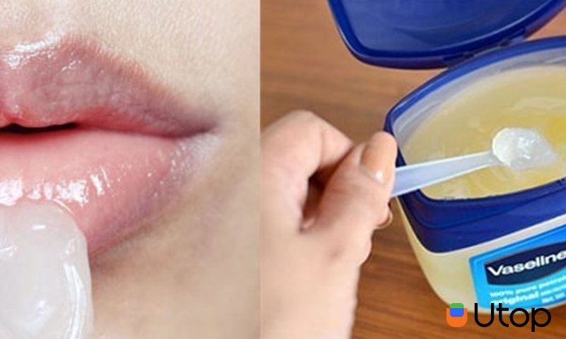 Đôi nét về lựa chọn số 1 dành cho da khô - Vaseline